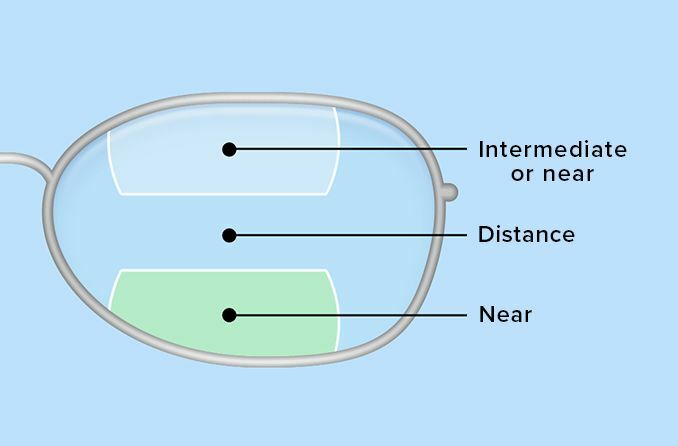 multifocal explanation graphic